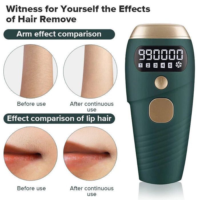 TAVICE IPL Hair Removal Device for Women and Men, 990,000 Flashes, At-Home Intense Pulsed Light Hair Remover for Face, Arms, Legs, Underarms, Bikini Line and Body - Battery Mate