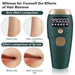 TAVICE IPL Hair Removal Device for Women and Men, 990,000 Flashes, At-Home Intense Pulsed Light Hair Remover for Face, Arms, Legs, Underarms, Bikini Line and Body - Battery Mate